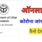 Up covid 19 report online