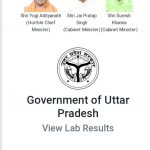 Up covid 19 online report